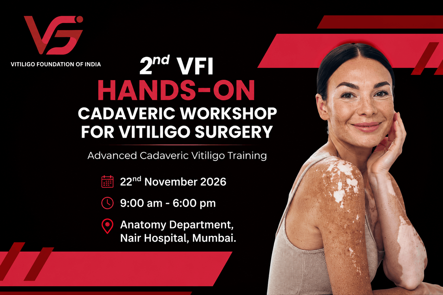 2nd VFI Hands-On Cadaveric Workshop For Vitiligo Surgery